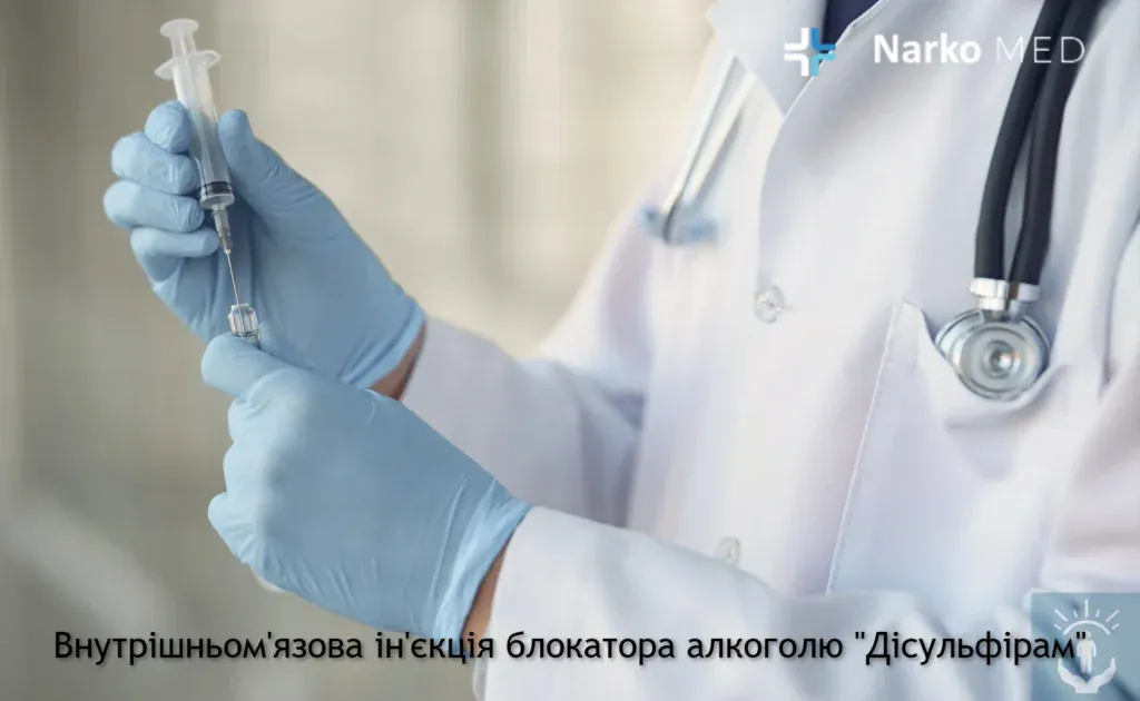 Внутрішньом'язова ін'єкція блокатора алкоголю "Дісульфірам"