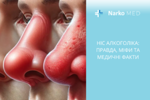 Ніс алкоголіка правда, міфи та медичні факти